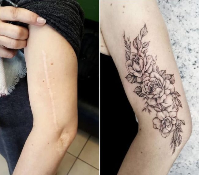 20 Incredible Tattoos That Cover Birthmarks and Scars (1)