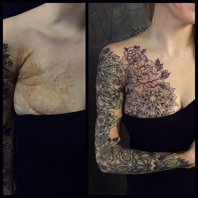 20 Incredible Tattoos That Cover Birthmarks and Scars (1)