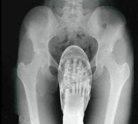 Embarrassing X Rays