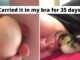 Woman Saves Cracked Egg By Carrying It In Her Bra For 35 Days