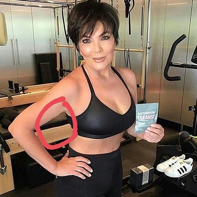 The Worst Kardashian Photoshop Fails Caught By Their Fans