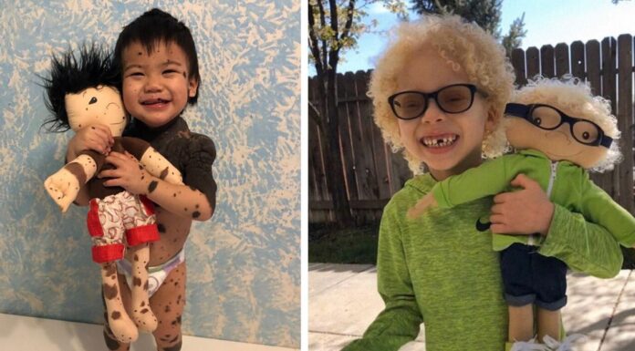 Woman Is Creating Look-Alike Dolls For Kids With Disabilities And It’s Touching Everyone’s Hearts