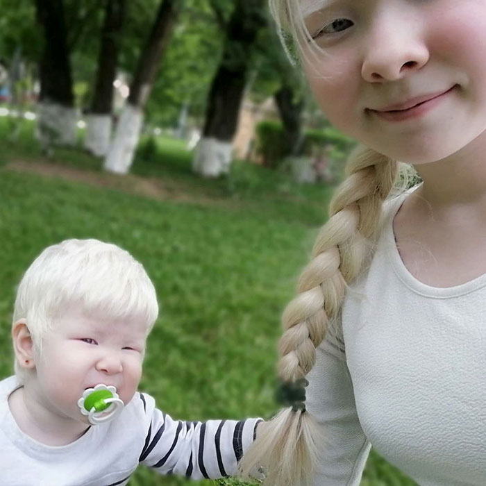 Albino Sisters Born 12 Years Apart Stun The World With Their Extraordinary Beauty