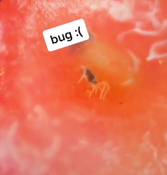 If You Put Strawberries Into Salt Water, Tiny Bugs Come Out Of Them
