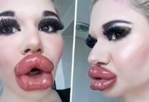 22 Year-old Student from Bulgaria Has World Big Lips Andrea Emilova Ivanova