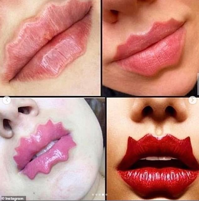 Wavy Lips Are The Latest Beauty Trend Taking Over Social Media