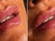 Wavy Lips Are The Latest Beauty Trend Taking Over Social Media